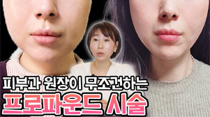 피부과 원장이 무조건하는 프로파운드 시술