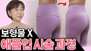 보형물X , 애플힙 시술과정